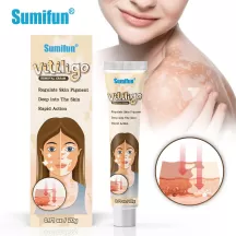 Sumifun Vitiligo Cream