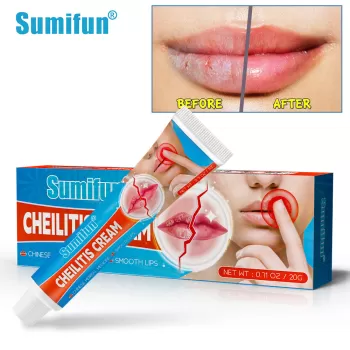 Sumifun Cheilitis Cream Sumifun Cheilitis Cream