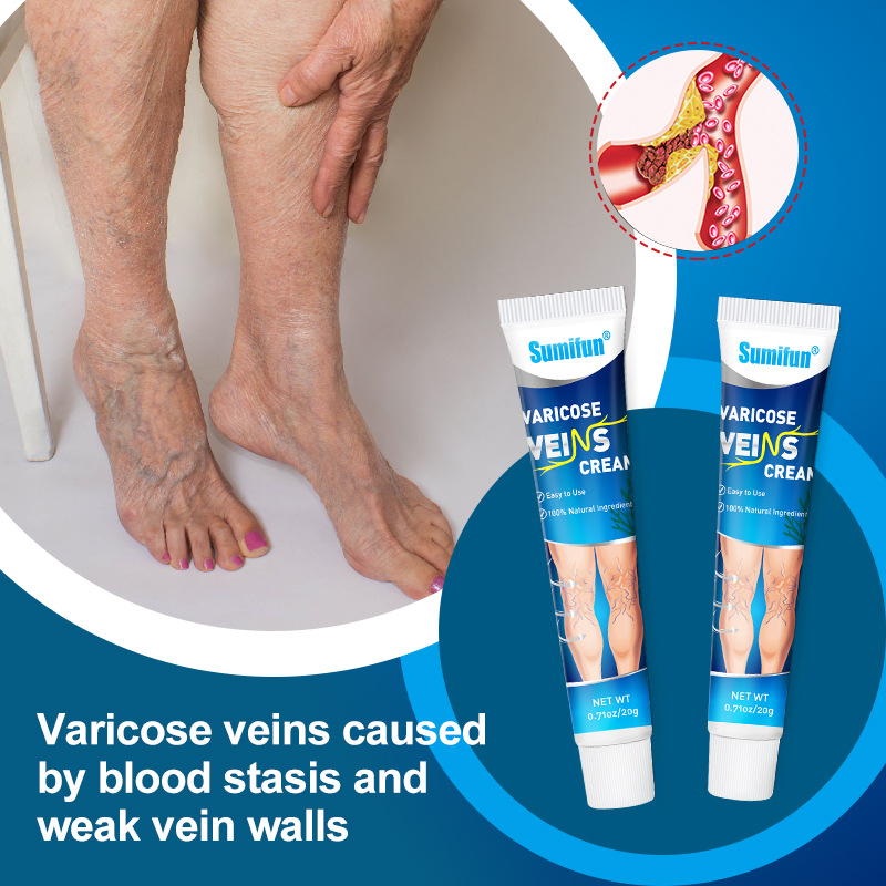 Sumifun Varicose Veins Cream Introduced-4