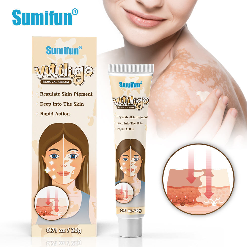 sumifun vitiligo cream introduced-1