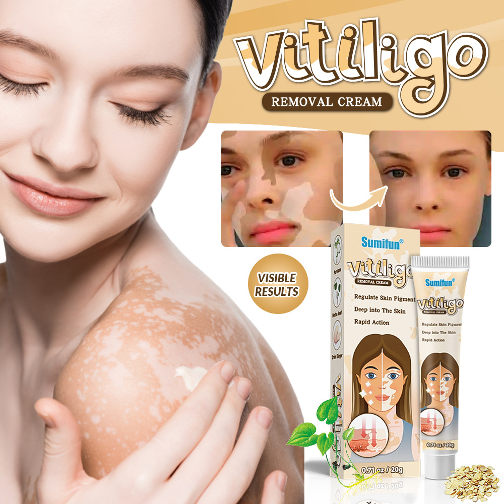 sumifun vitiligo cream introduced-2