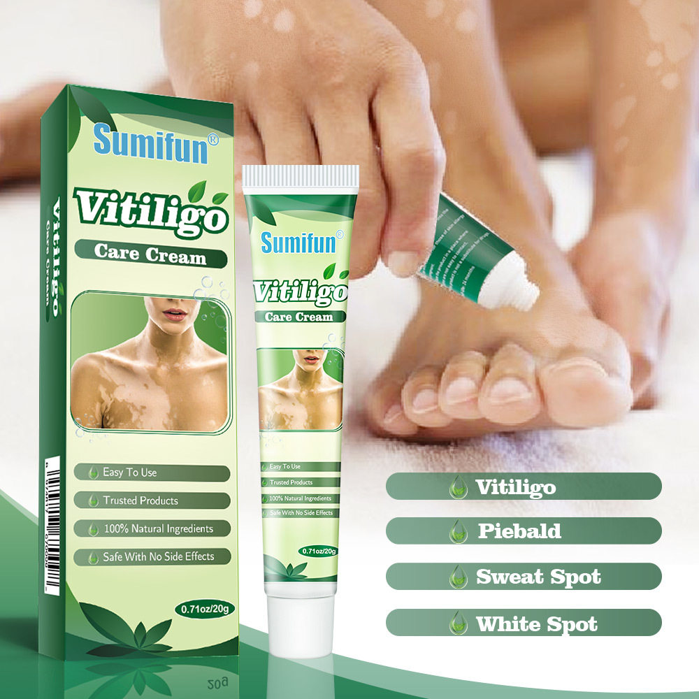 sumifun vitiligo cream introduced-4